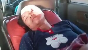 Suami Putus Asa Cari Biaya Operasi untuk Istri yang Tertimpa Pohon